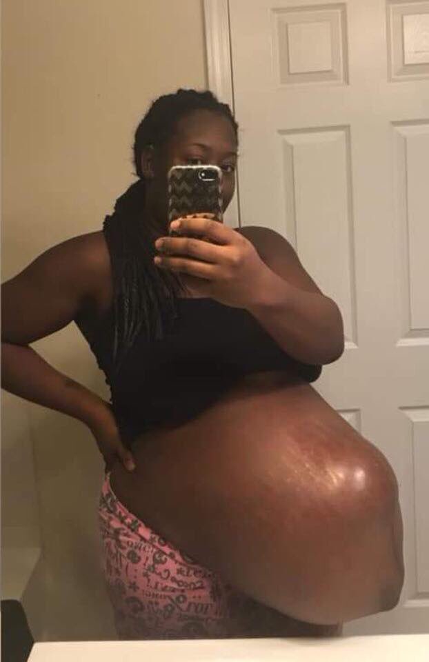 Pregnant Woman. 